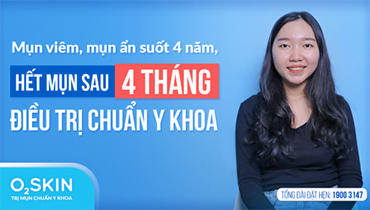 Mụn 4 Năm Và Hành Trình Cứu Vãn Làn Da Nhiễm Corticoid Sau Khi Sử Dụng Sản Phẩm Kém Chất Lượng