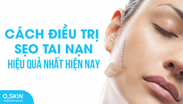 Cách Điều Trị Sẹo Tai Nạn Hiệu Quả Nhất Hiện Nay