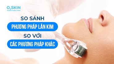 So Sánh Phương Pháp Lăn Kim So Với Các Phương Pháp Khác