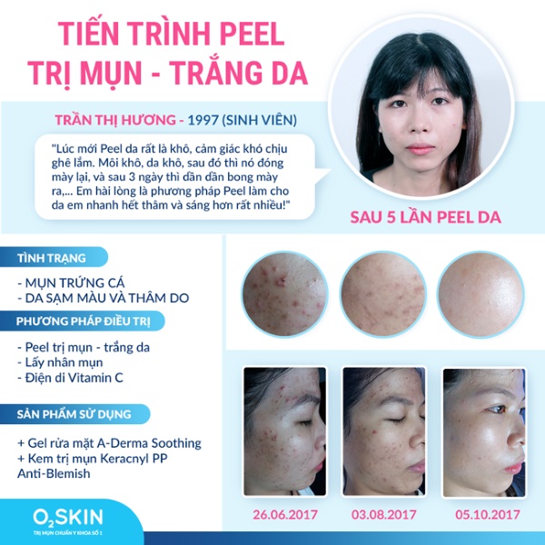 Tác dụng của Peel da