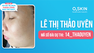 Lê Thị Thảo Uyên