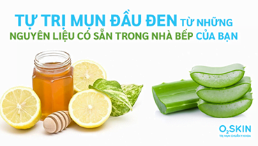 Tự Trị Mụn Đầu Đen Từ Những Nguyên Liệu Có Sẵn Trong Nhà Bếp Của Bạn