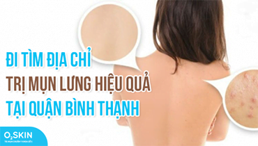 Đi Tìm Địa Chỉ Trị Mụn Lưng Hiệu Quả Tại Quận Bình Thạnh