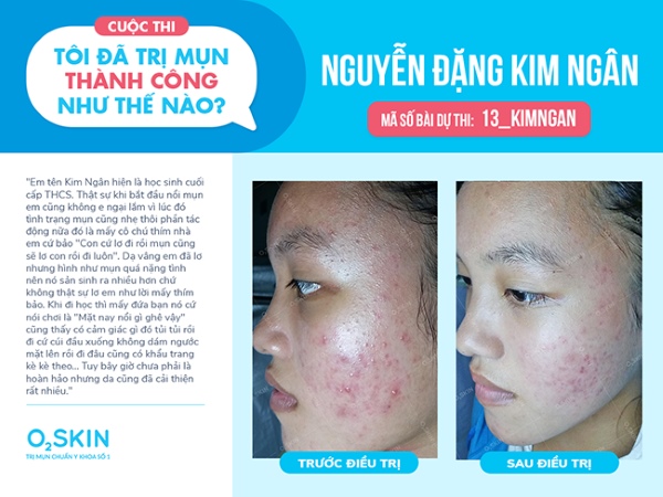 Bạn Nguyễn Đặng Kim Ngân