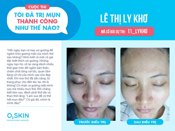 Bạn Ly Khơ, hiện đang là sinh viên năm 4 của trường ĐH Sư phạm Tp.Hồ Chí Minh