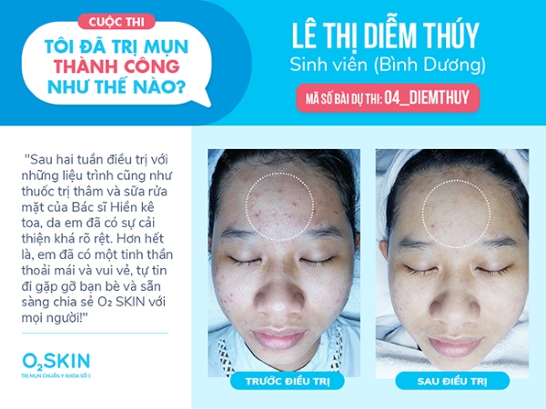 Em tên là Lê Thị Diễm Thúy, là sinh viên năm 3 của trường Đại học Nông Lâm TPHC