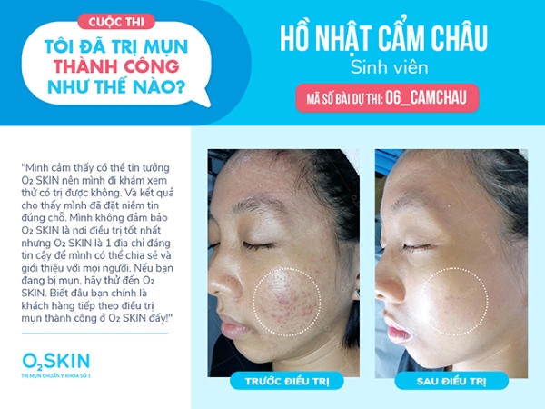 Bạn Cẩm Châu - sinh viên đại học Luật Tp. Hồ Chí Minh.