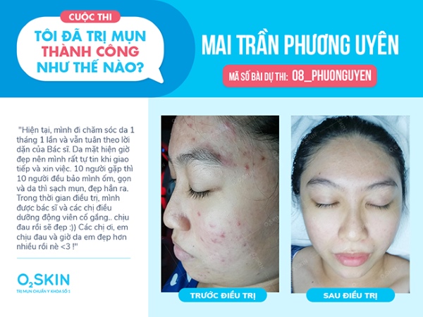 Bạn Mai Trần Phương Uyên