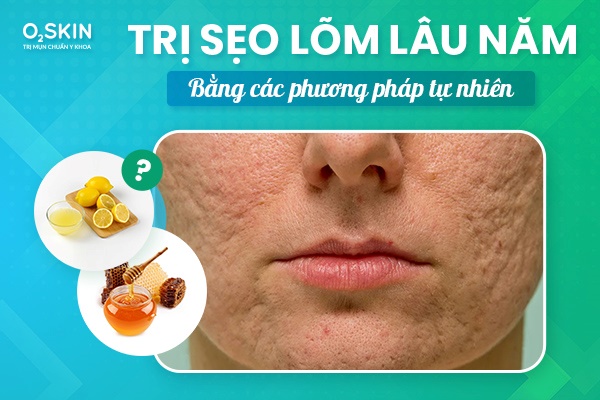 Trị sẹo lõm lâu năm bằng các phương pháp tự nhiên