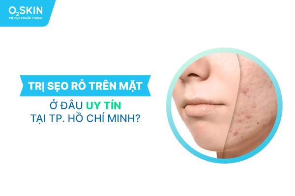 Trị sẹo rỗ trên mặt ở đâu uy tín tại Tp. Hồ Chí Minh?