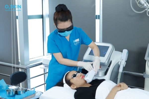 IPL xử lý mụn bọc