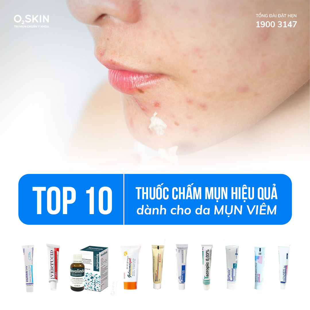 3. Các Triệu Chứng Nhận Biết Mụn Viêm