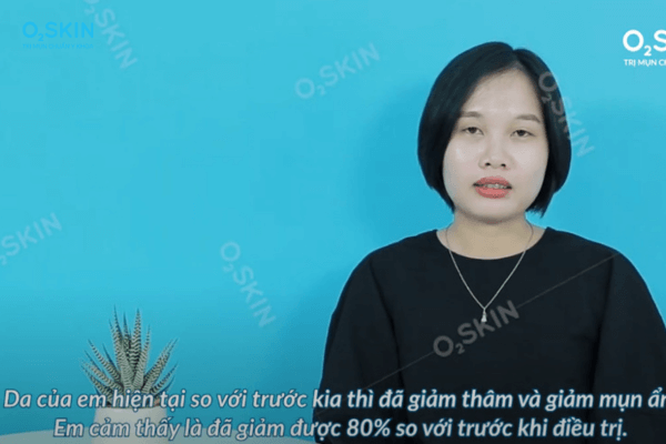 Da của Trang sau 2 tháng điều trị tại O2 SKIN khắc phục rõ rệt