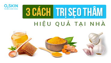 Sẹo thâm là gì? 3 cách trị sẹo thâm hiệu quả tại nhà