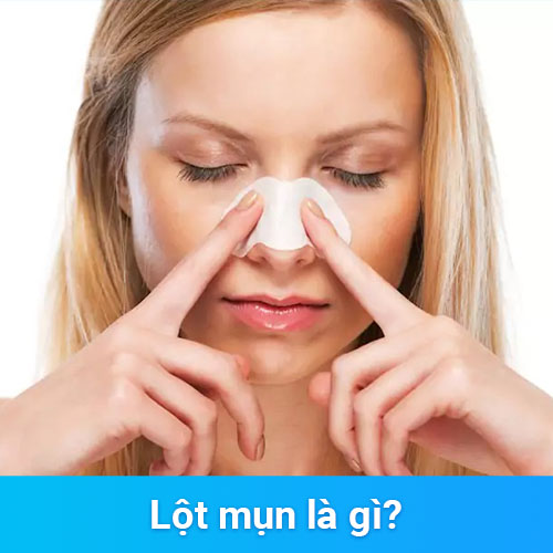 Lột mụn là gì?