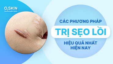 Sẹo lồi là gì? Các phương pháp trị sẹo lồi tốt nhất hiện nay