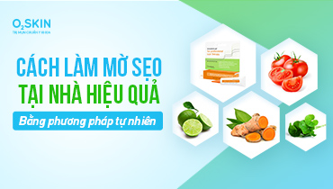 Cách làm mờ sẹo tại nhà hiệu quả bằng phương pháp tự nhiên