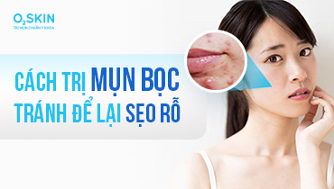 Tổng hợp các cách trị mụn bọc hiệu quả, hạn chế bị thâm sẹo