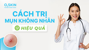 Tìm hiểu mụn bọc không đầu là gì? Nguyên nhân và cách điều trị