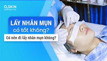 Lấy Nhân Mụn Có Tốt Không? Có Nên Đi Lấy Nhân Mụn?