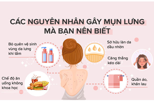 Nguyên nhân gây ra mụn lưng