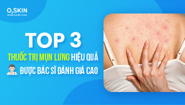 Top 3 Thuốc Trị Mụn Lưng Hiệu Quả Được Bác Sĩ Đánh Giá Cao