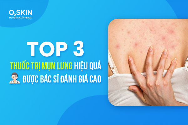 Thuốc uống trị mụn lưng: Thông tin chi tiết và cách sử dụng