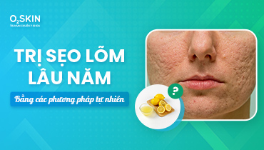 Trị sẹo lõm lâu năm bằng tự nhiên, Bác sĩ da liễu nói gì?