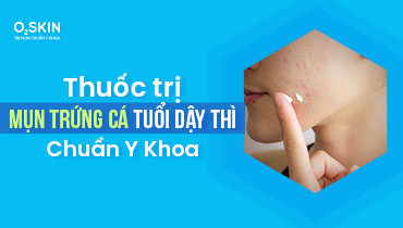 Thuốc trị mụn tuổi dậy thì chuẩn y khoa