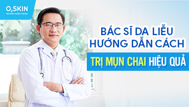 Mụn chai là gì? Nguyên nhân, cách điều trị và ngăn ngừa