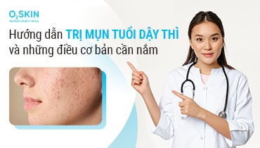 Cách trị mụn tuổi dậy thì và những điều cơ bản cần nắm