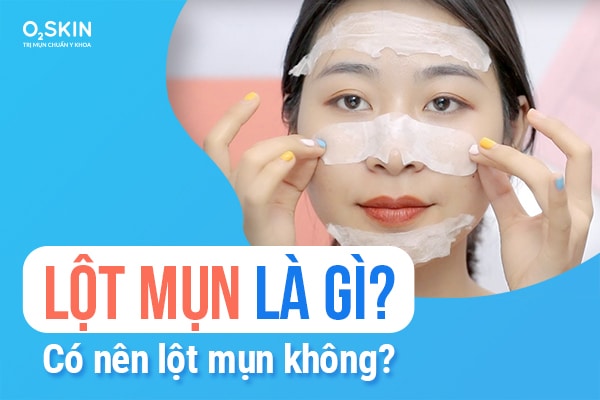 Những lưu ý khi lột mụn tại nhà