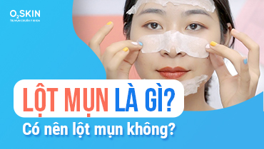 Có nên lột mụn không? Cách lột mụn đầu đen tại nhà