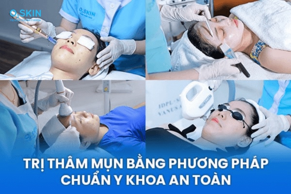 cách trị thâm mụn tại nhà