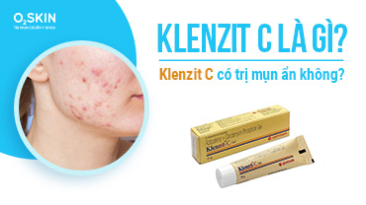 3. Klenzit C có thực sự trị mụn không?