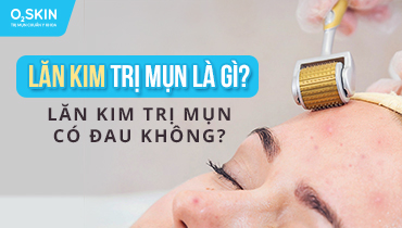 Lăn kim trị mụn có hiệu quả không và những điều bạn cần biết