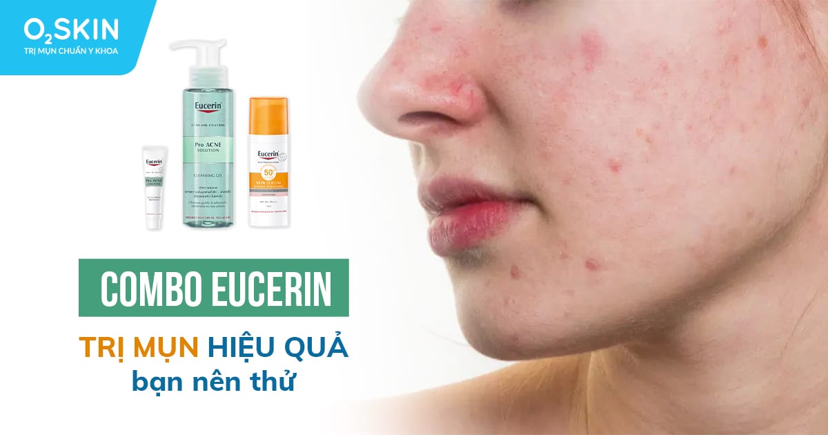 Combo Eucerin trị mụn hiệu quả bạn nên thử