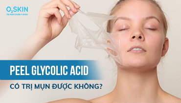 Glycolic Acid là gì? Có trị mụn được không?