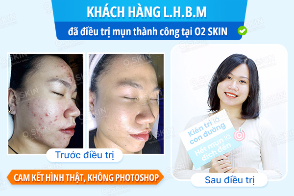 Khách hàng Lê Hồng Bảo Minh