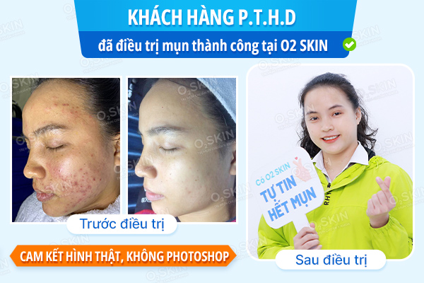 Khách hàng Phạm Thị Hồng Dung