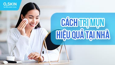 Thực hư cách trị mụn tại nhà hiệu quả sau 1 đêm