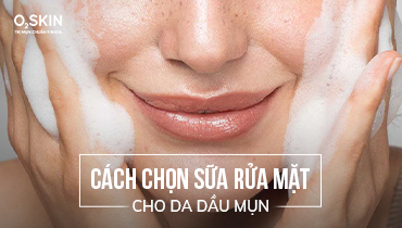 Da dầu mụn nên dùng sữa rửa mặt nào? Hướng dẫn cách lựa chọn phù hợp