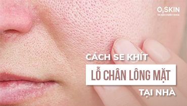 Cách Se Khít Lỗ Chân Lông Mặt Tại Nhà