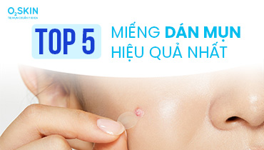 Top 5 miếng dán mụn hiệu quả nhất