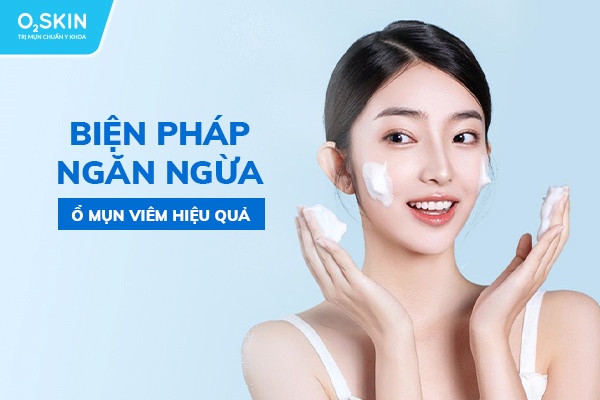 Biện pháp ngăn ngừa ổ mụn viêm hiệu quả