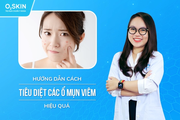 Hướng dẫn cách tiêu diệt các ổ mụn viêm hiệu quả