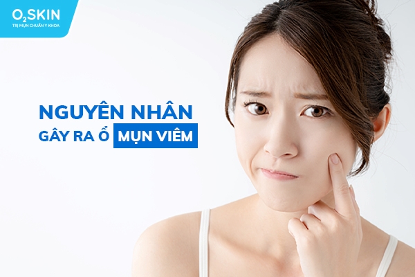 Nguyên nhân gây ra ổ mụn viêm