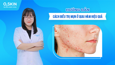 Mụn ở quai hàm: Nguyên nhân, cách điều trị và ngăn ngừa