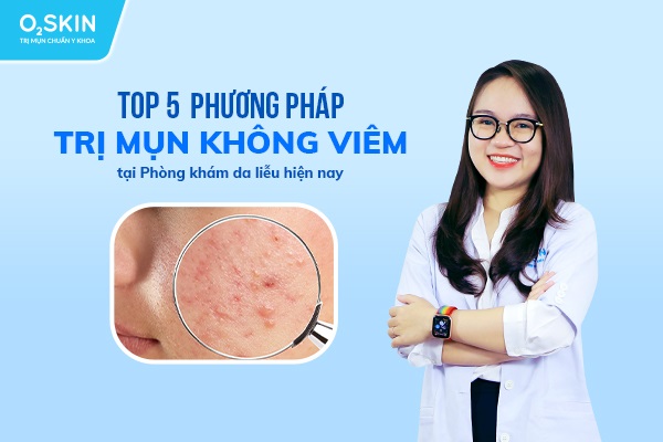 Mụn không viêm là gì