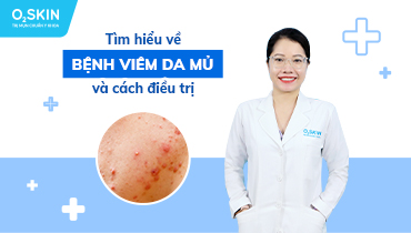 Viêm da mụn mủ: Nguyên nhân và cách chữa trị